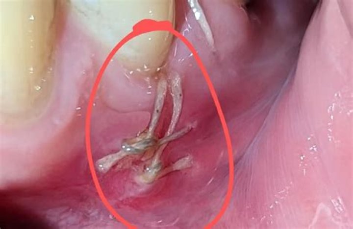 How do I dissolve my C Corp?