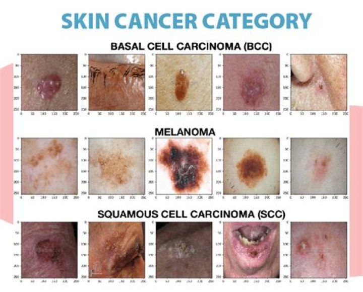 Is skin cancer a Recognised disability?