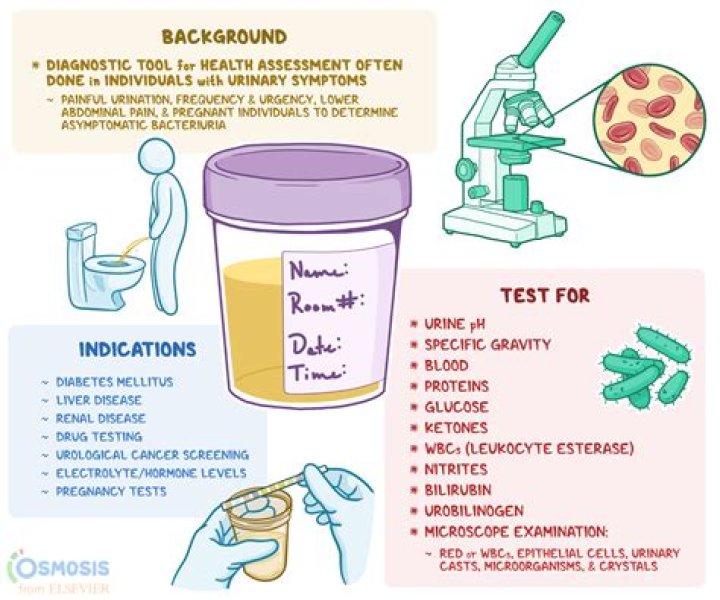 What is included in a reserve study?